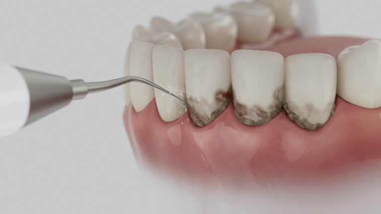 Reliable Dental contractor in Vance, AL by Smile Center Dentistry